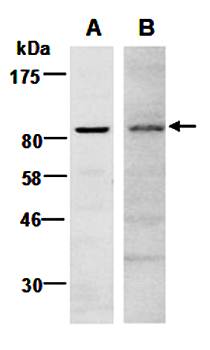 EZH2 antibody