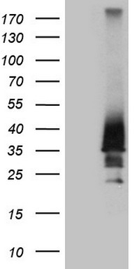 Ezrin (EZR) antibody