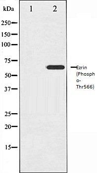 Ezrin (Phospho-Thr566) antibody