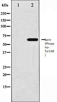 Ezrin (Phospho-Tyr146) antibody