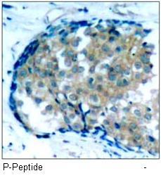 Ezrin (Phospho-Tyr353) Antibody