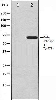 Ezrin (Phospho-Tyr478) antibody