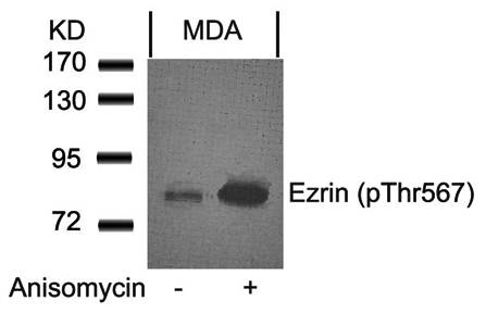 Ezrin (Phospho-Thr567) Antibody
