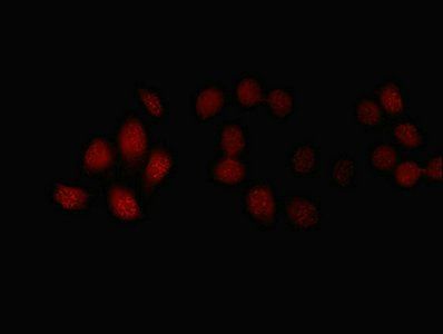 F-box/LRR-repeat protein 18 antibody