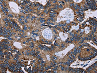 F11R Antibody