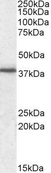 F11R antibody