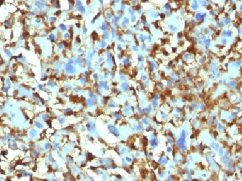 Factor XIIIa (Coagulation Factor XIIIA Chain) Antibody