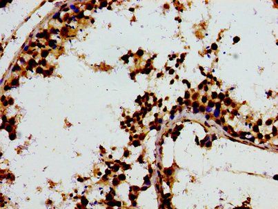 F13A1 Antibody