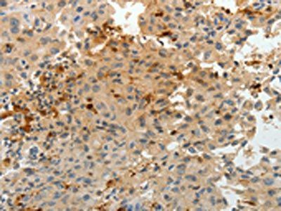 F13A1 Antibody
