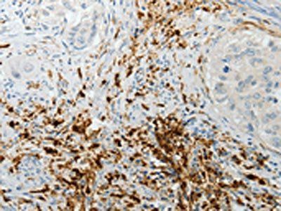 F13A1 antibody