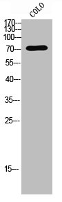 F13B antibody