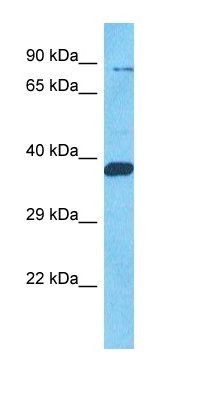 F16P1 antibody