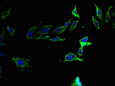 F2 antibody