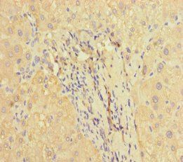 F2R Antibody