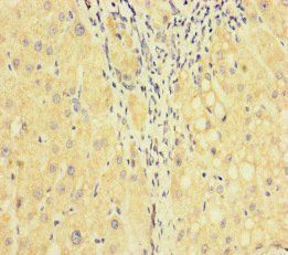 F5 Antibody