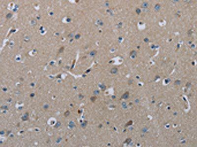 FAAH Antibody