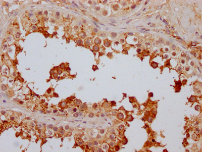 FAAH Recombinant Monoclonal Antibody