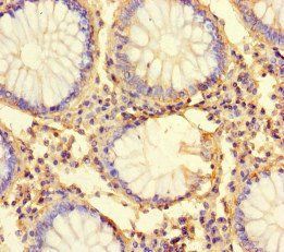 FAAP20 Antibody