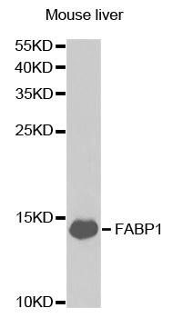 FABP1 antibody
