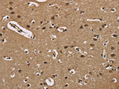 FABP2 Antibody