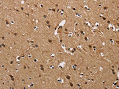 FABP2 Antibody