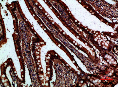 FABP2 Antibody