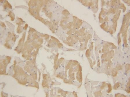 Cardiac FABP/FABP3 Antibody