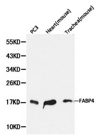 FABP4 antibody