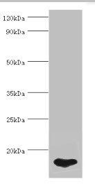 FABP5 Antibody