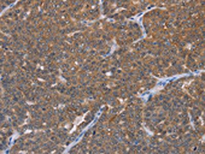 FABP6 Antibody