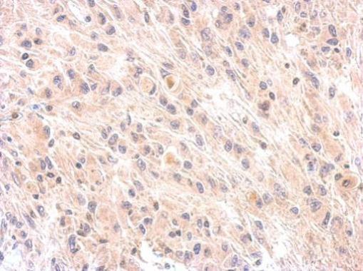Factor H Rabbit Polyclonal Antibody