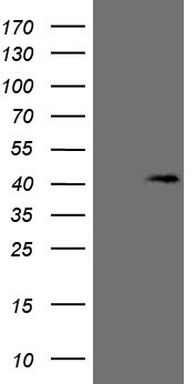 Factor I (CFI) antibody