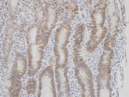 Factor VII Rabbit Polyclonal Antibody