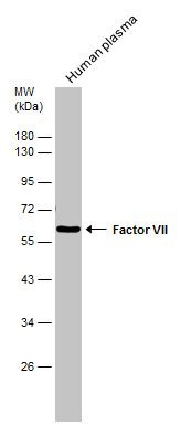 Factor VII Rabbit Polyclonal Antibody