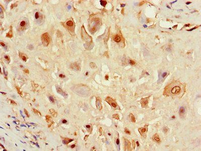 F8 Antibody
