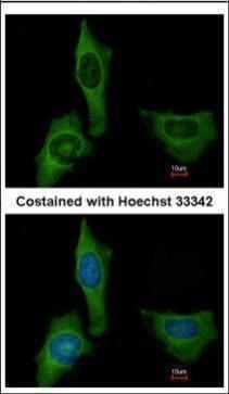 Factor X Rabbit Polyclonal Antibody