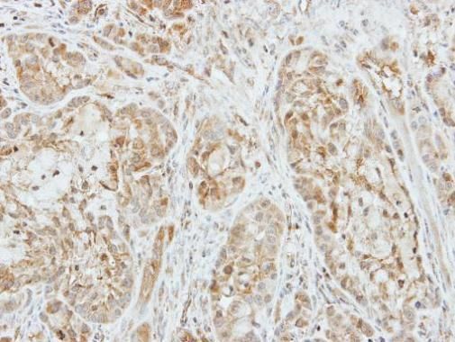 Factor X Rabbit Polyclonal Antibody