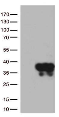 Factor X (F10) antibody