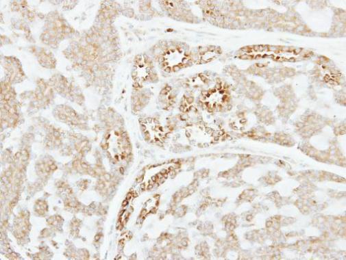 Factor XI Rabbit Polyclonal Antibody