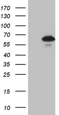 Factor XII (F12) antibody