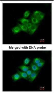 Factor XIIIa antibody [N1N3]