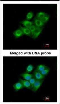 Factor XIII antibody