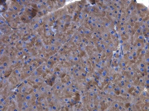 Factor XIIIa Rabbit Polyclonal Antibody