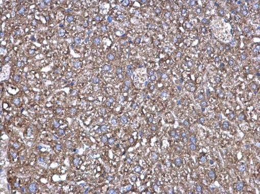 Factor XIIIa Rabbit Polyclonal Antibody