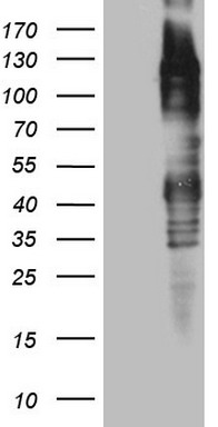 Factor XIII (F13B) antibody
