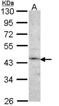 Factor IX antibody