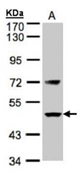 Factor VII antibody