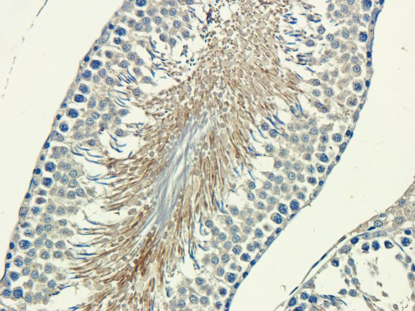 Factor VIII Rabbit Polyclonal Antibody