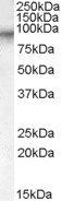 Goat anti-Factor XIIIa (703-717) Antibody