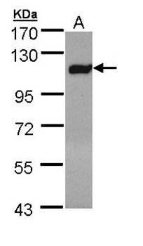 Factor XIIIa antibody